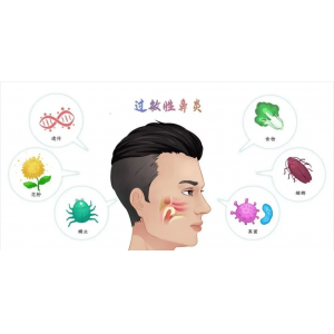 銘仁耳鼻喉專(zhuān)家分享：如何一招解決過(guò)敏性鼻炎的打噴嚏流鼻涕！