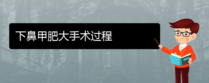 (貴陽鼻科醫(yī)院掛號)下鼻甲肥大手術過程(圖1)