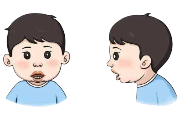 孩子打呼嚕是睡得香？注意可能是鼾癥惹的禍(圖2)