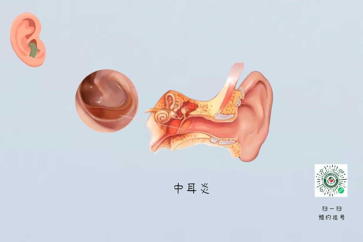手術(shù)沒做干凈，術(shù)后3年顱內(nèi)竟發(fā)現(xiàn)巨大膽脂瘤！(圖4)