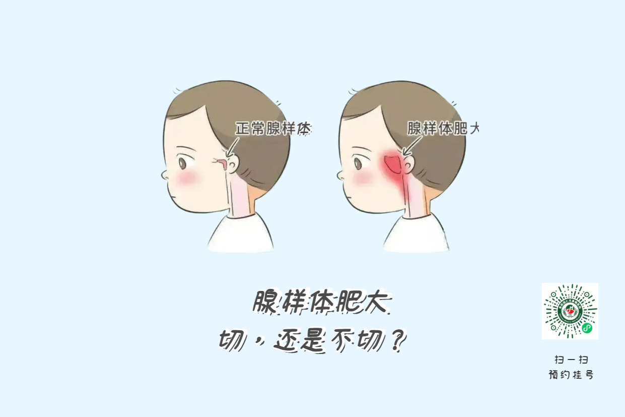 暑假來(lái)了，孩子腺樣體肥大到底切不切？(圖1)