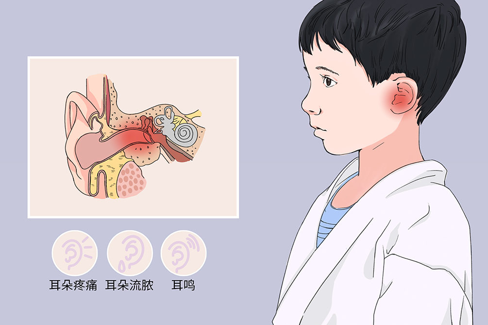 中耳炎雖小，但其危害不容小覷！(圖1)