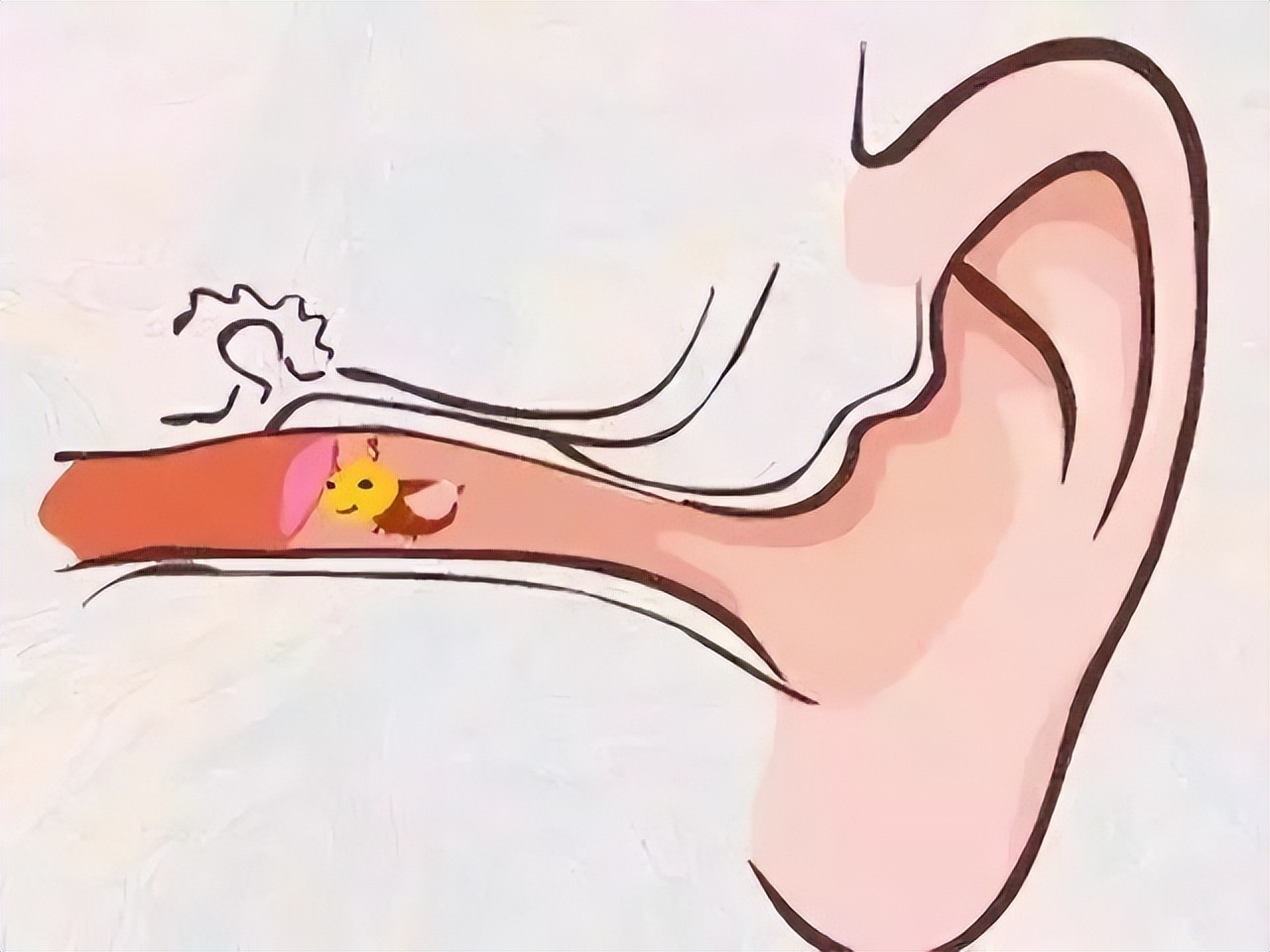 聽(tīng)力下降絕非小事，若不及時(shí)干預(yù)，嚴(yán)重會(huì)導(dǎo)致耳聾(圖1)