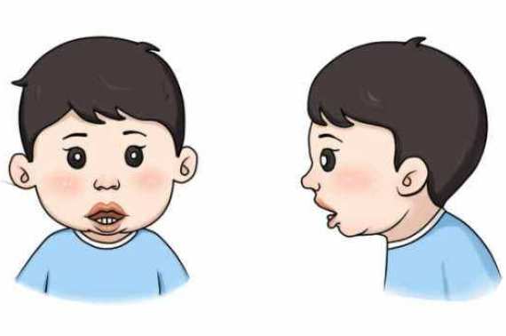 專家分享：父母注意！孩子腺樣體肥大如果忽略，后果很嚴(yán)重！(圖2)