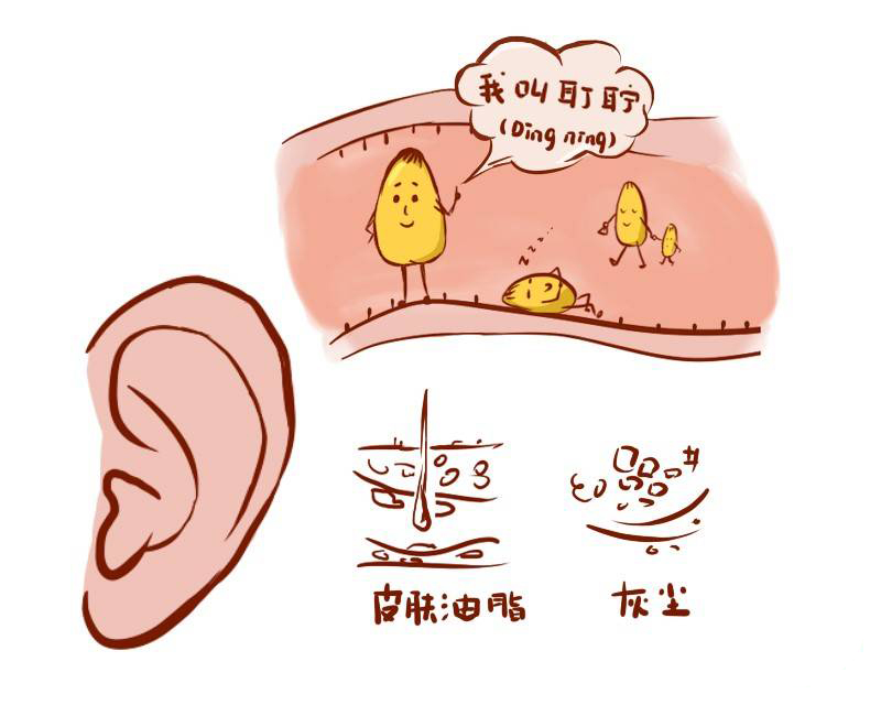 耳朵里耳屎多，到底要不要掏，正確處理方式是？(圖1)