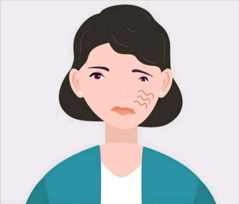 中耳炎會(huì)引起面癱，是真的嗎？(圖3)