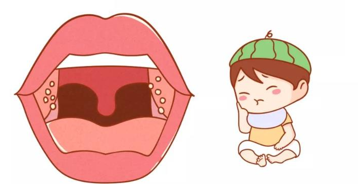 孩子扁桃體為何頻繁發(fā)炎？(圖1)