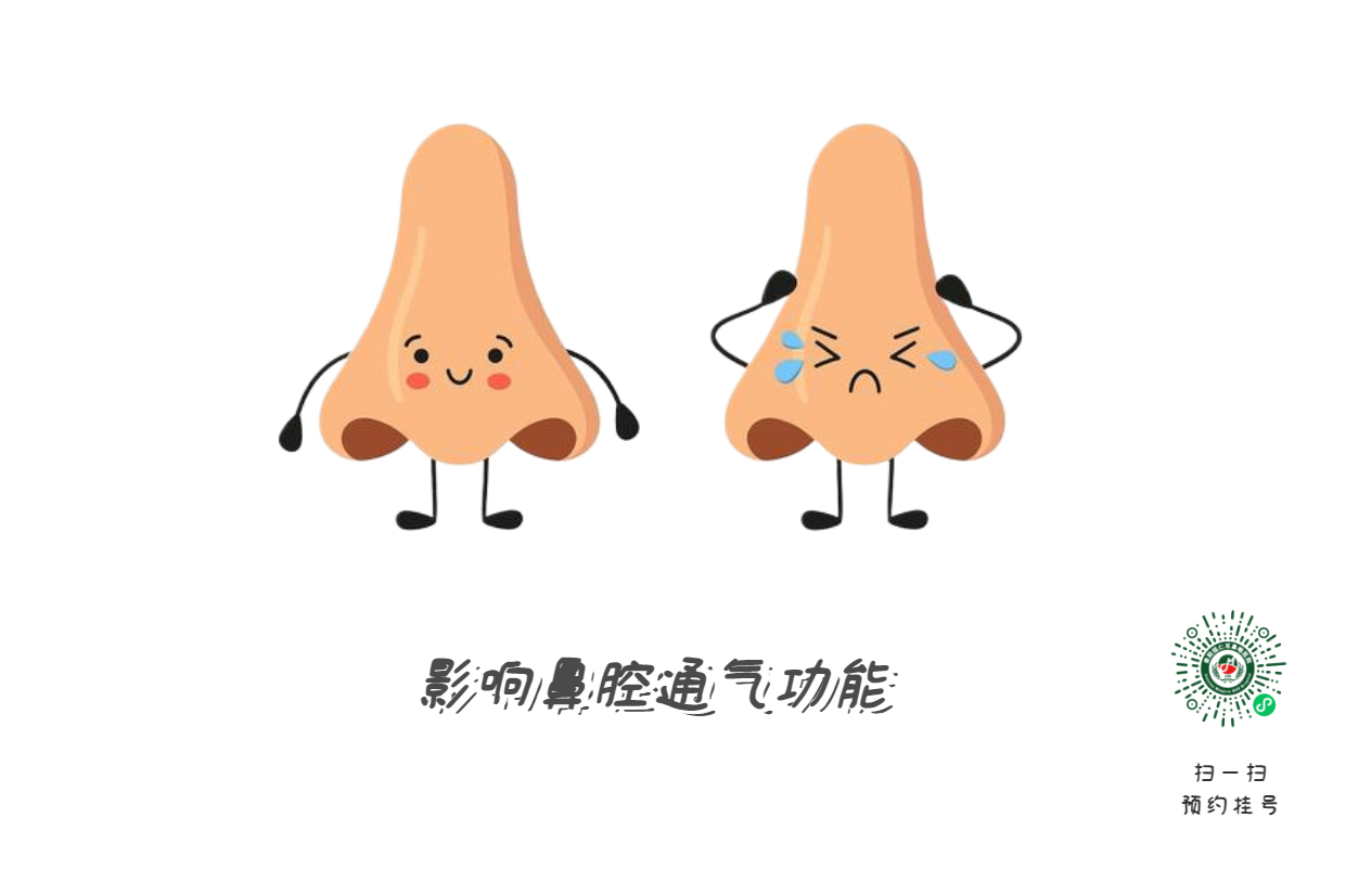 別把鼻塞當(dāng)小事 它可能是鼻腔內(nèi)的“隱形戰(zhàn)爭”(圖2)