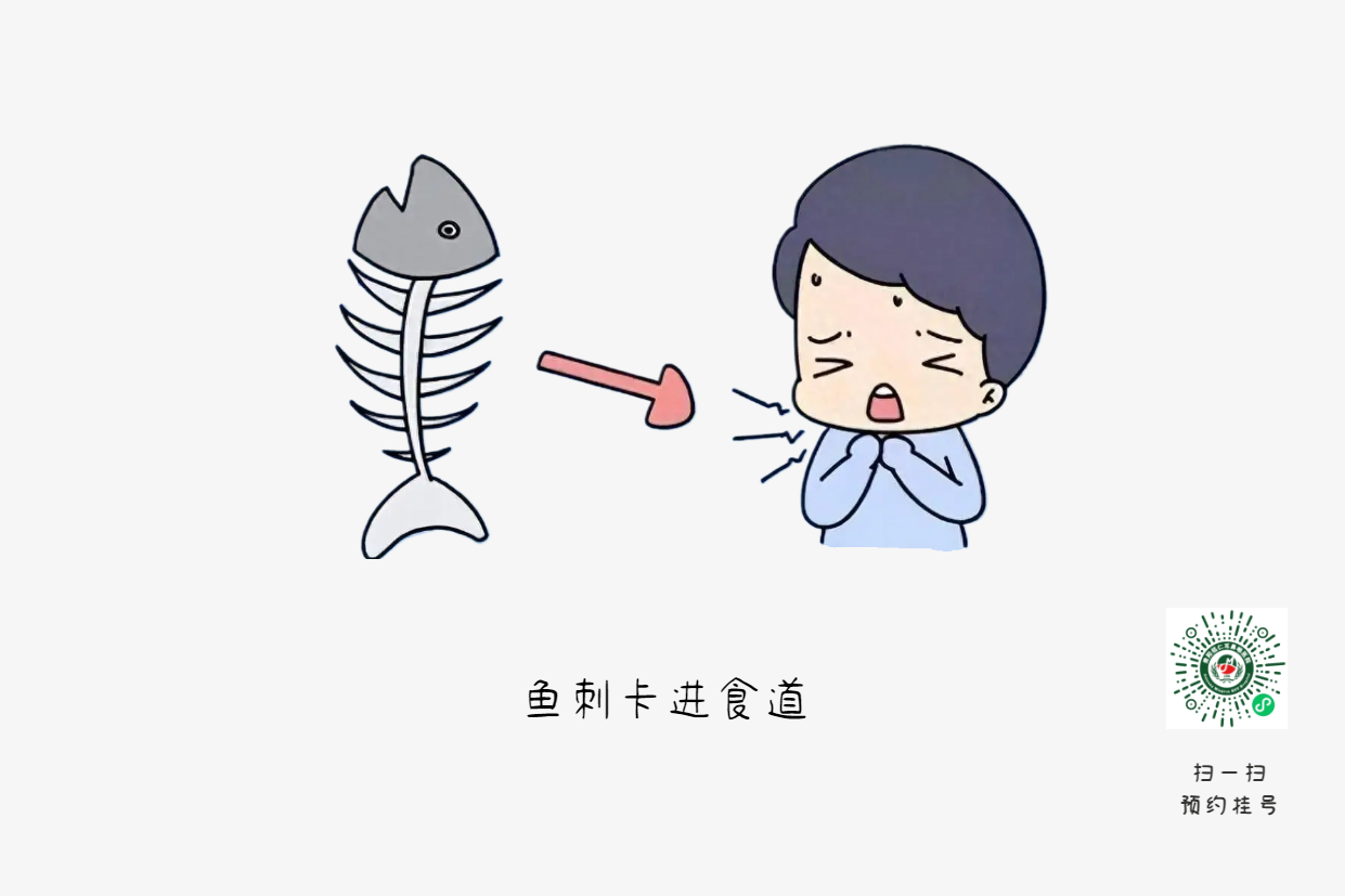 喉嚨卡魚刺？喝醋吞飯都是致命錯誤(圖1)